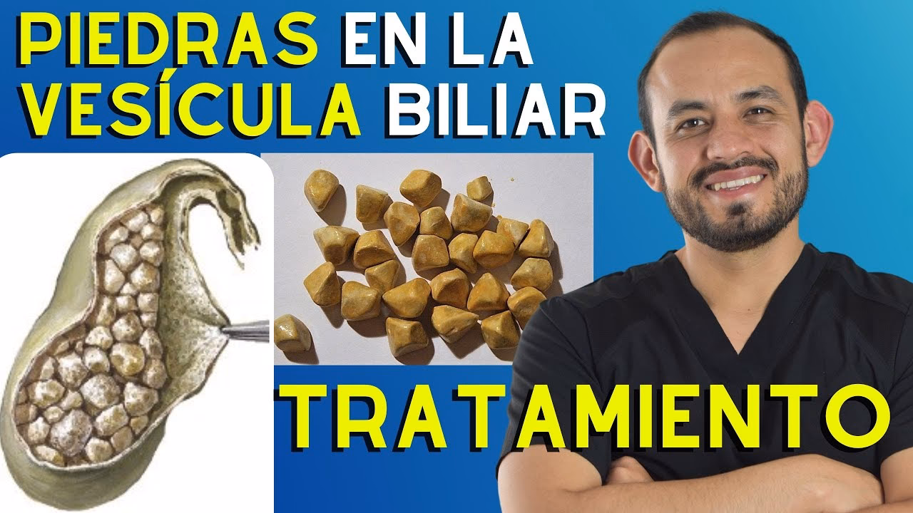 ¿Puede la acupuntura disolver los cálculos biliares?