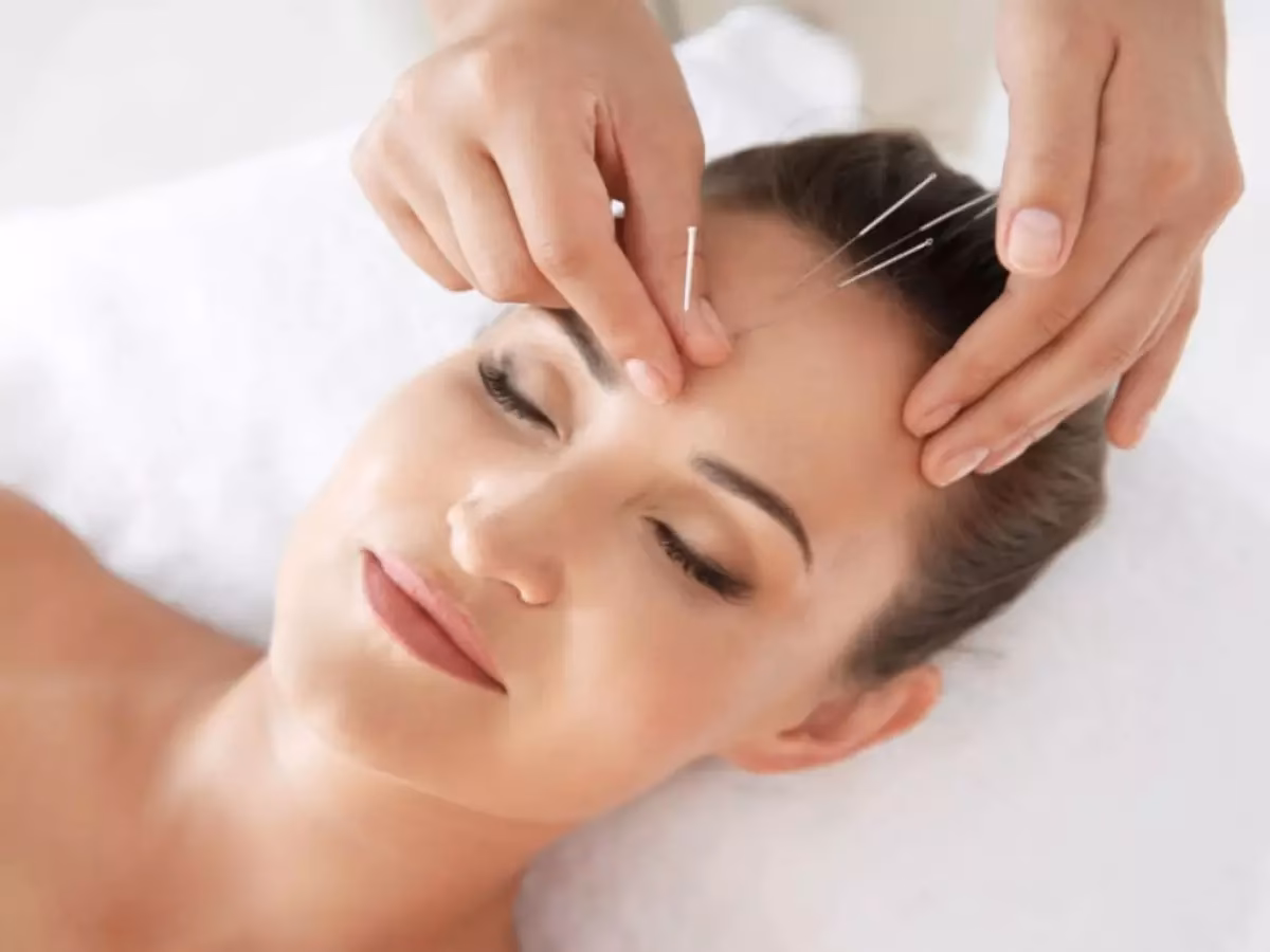 Onde fica o ponto da enxaqueca?