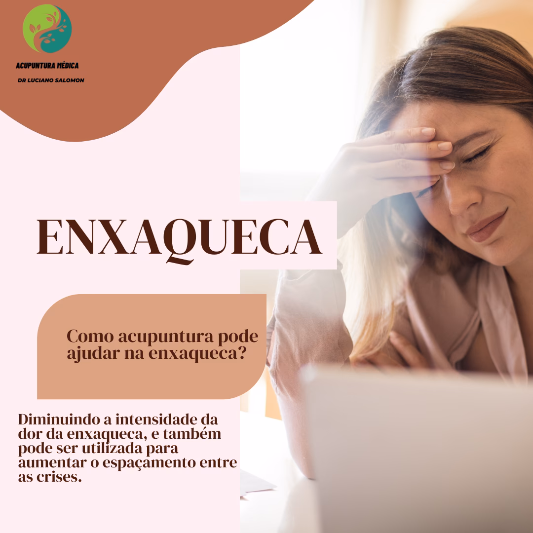 Quais os pontos de acupuntura para enxaqueca?