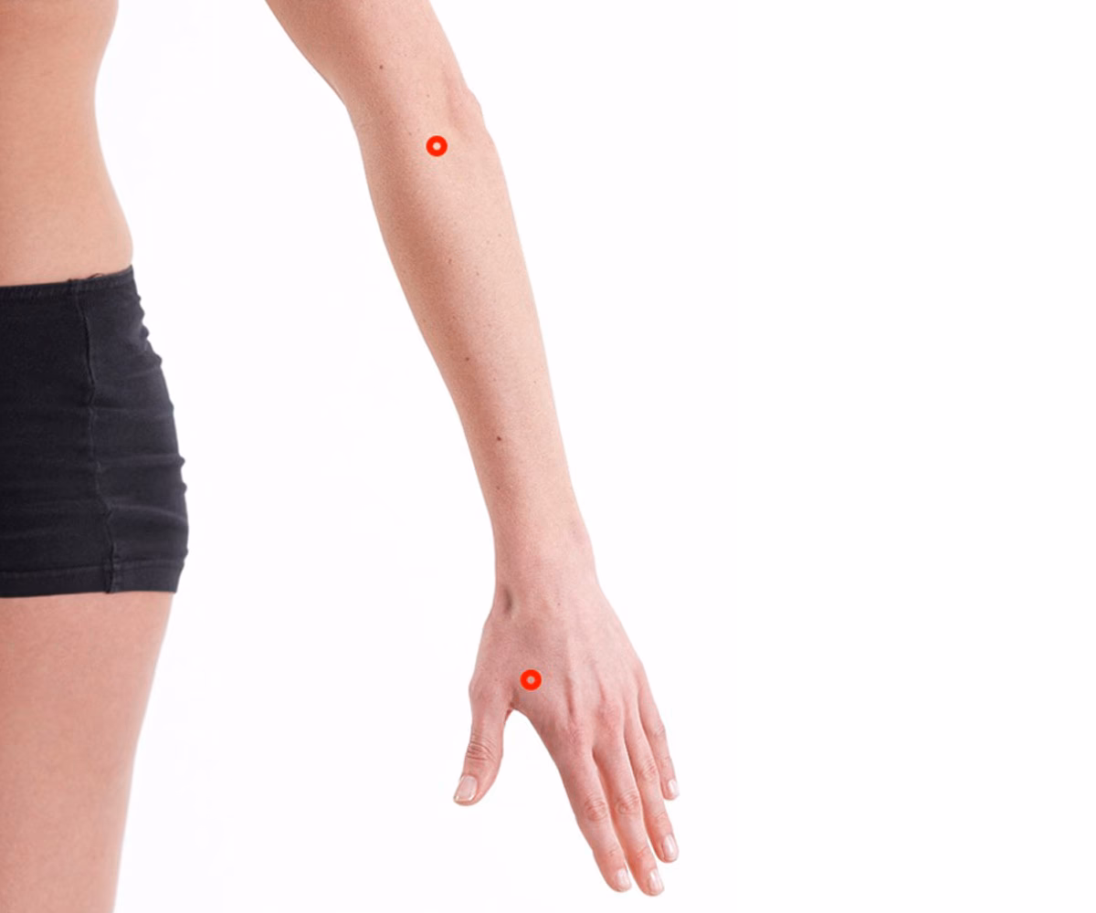 ¿Cuántas sesiones de acupuntura se necesitan para el codo de tenista?