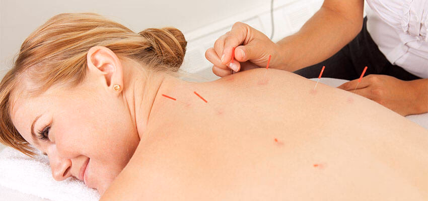 Quais os pontos de acupuntura para fertilidade feminina?