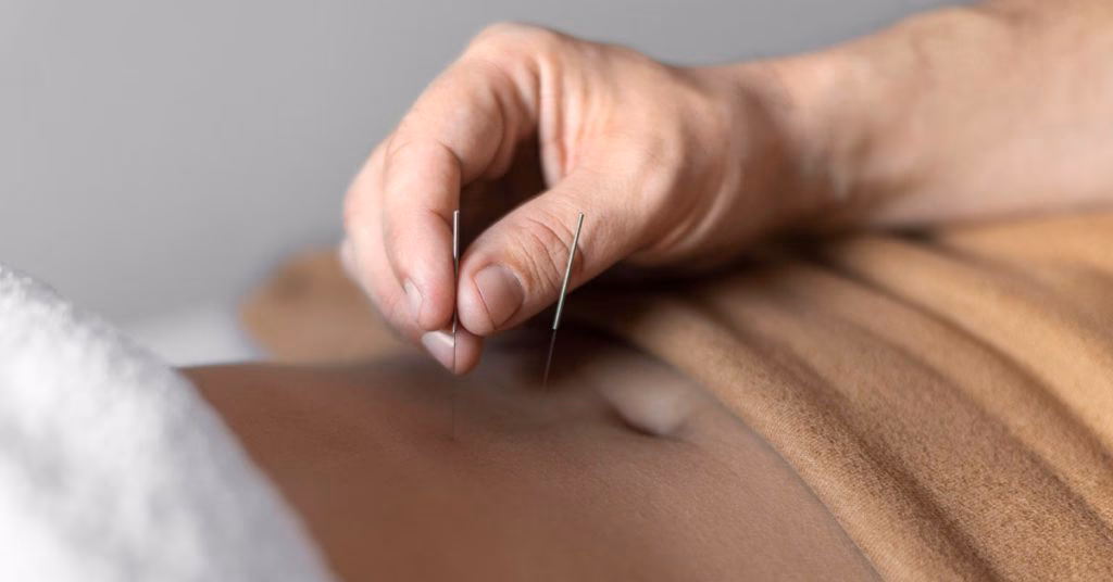 ¿Qué tan efectiva es la acupuntura para la incontinencia?