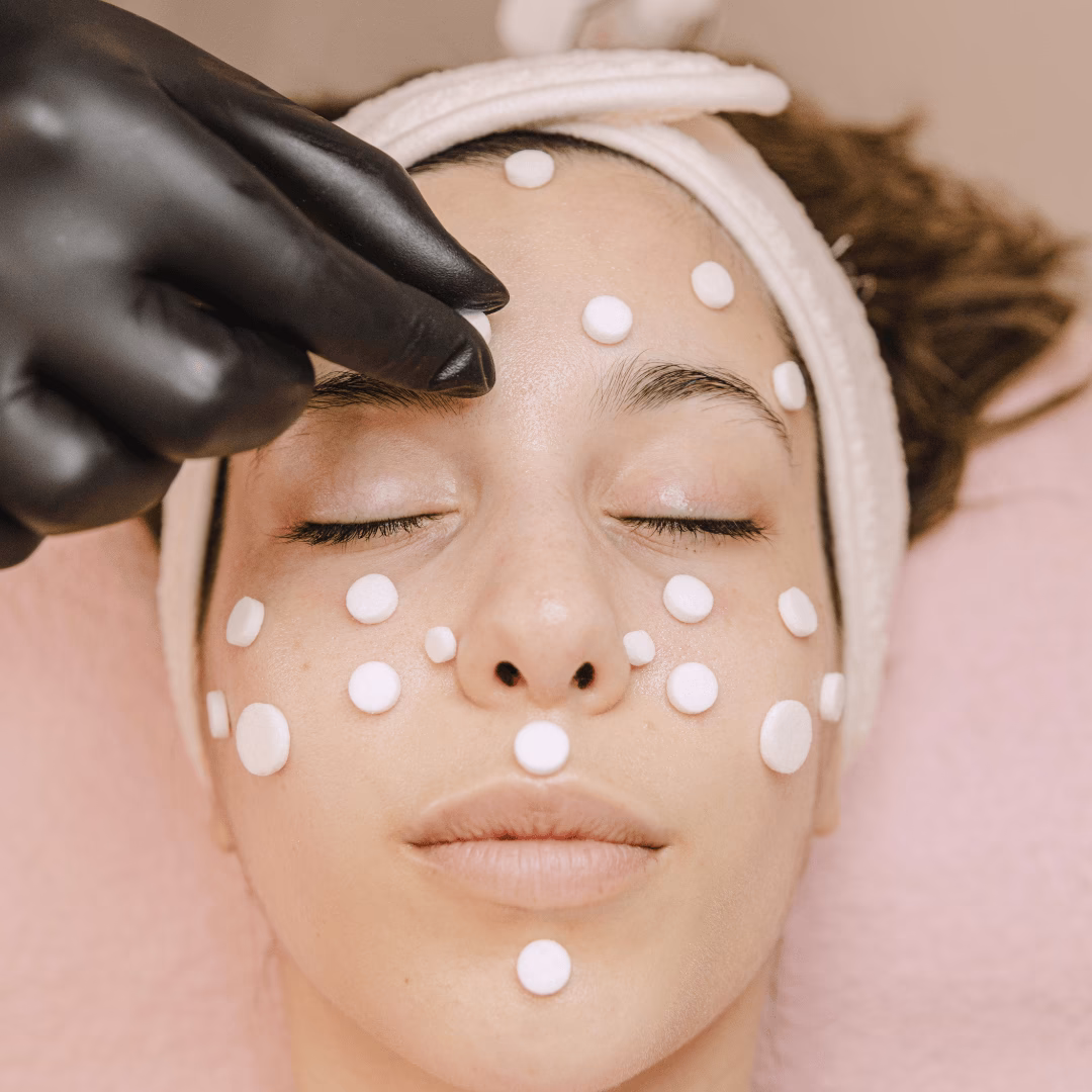 ¿Existe una cura mágica para la rosácea?