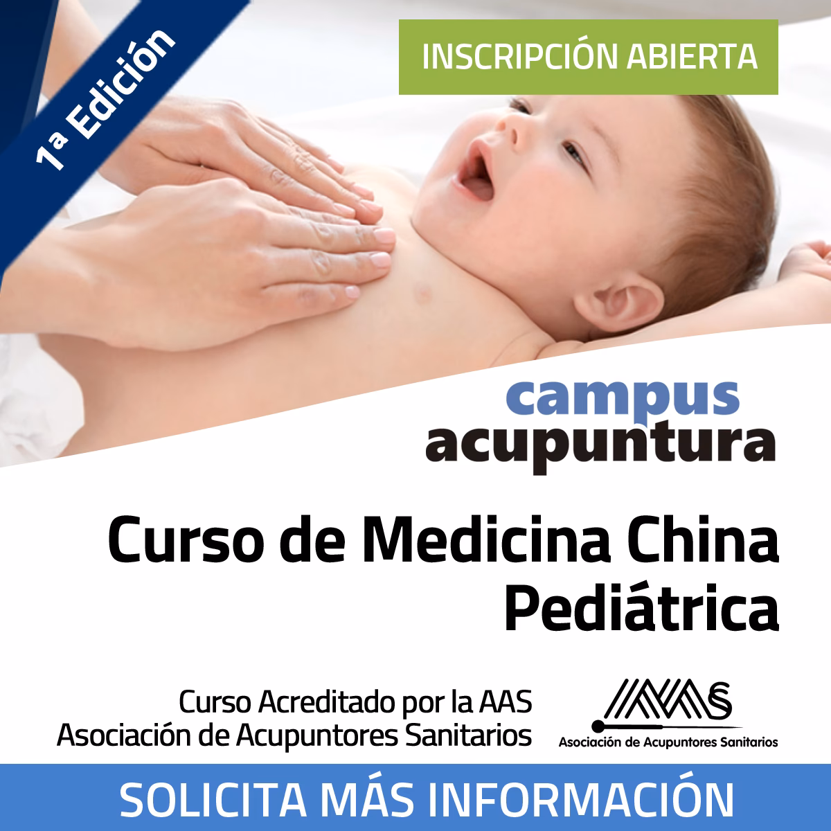 ¿Dónde se colocan las agujas de acupuntura para el TDAH?