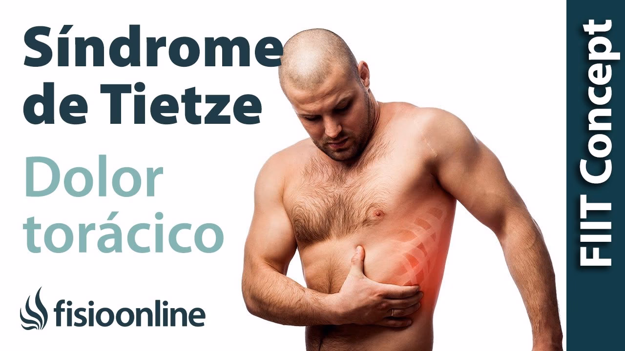 ¿Qué relajante muscular es bueno para la costocondritis?