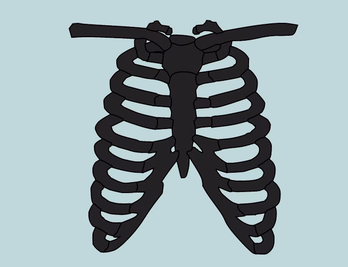 ¿Cómo quitar el síndrome de Tietze?