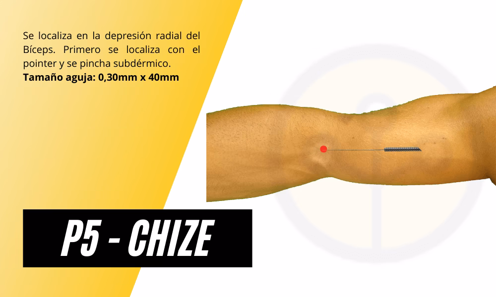 ¿Cuánto tiempo tarda en hacer efecto la acupuntura para tratar la tendinitis?