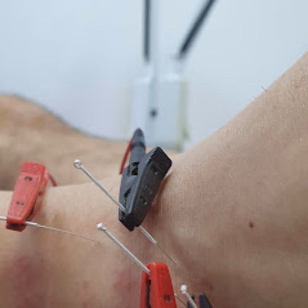 ¿Cómo desinflamar rápidamente un tobillo?