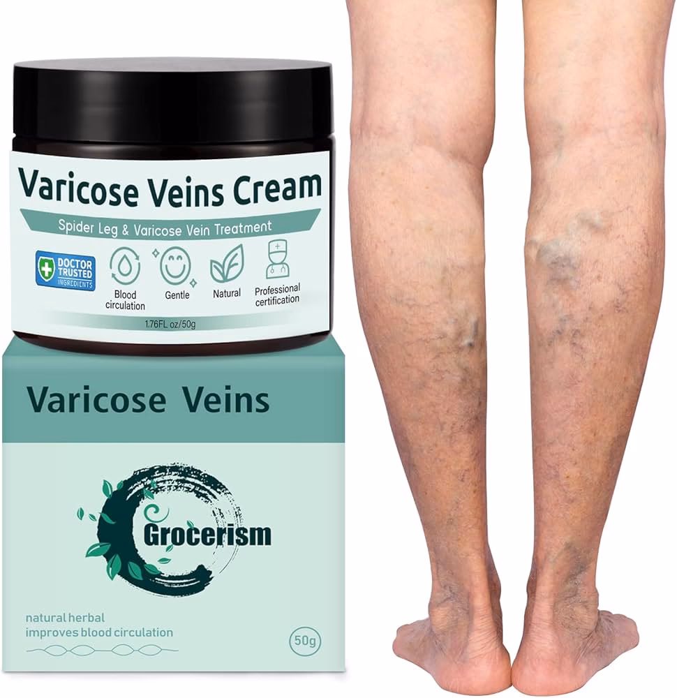 ¿Qué terapia es buena para las varices?