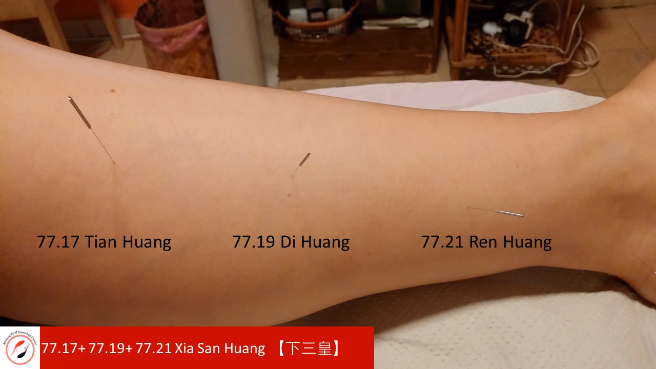 Can caffeine cause proteinuria?