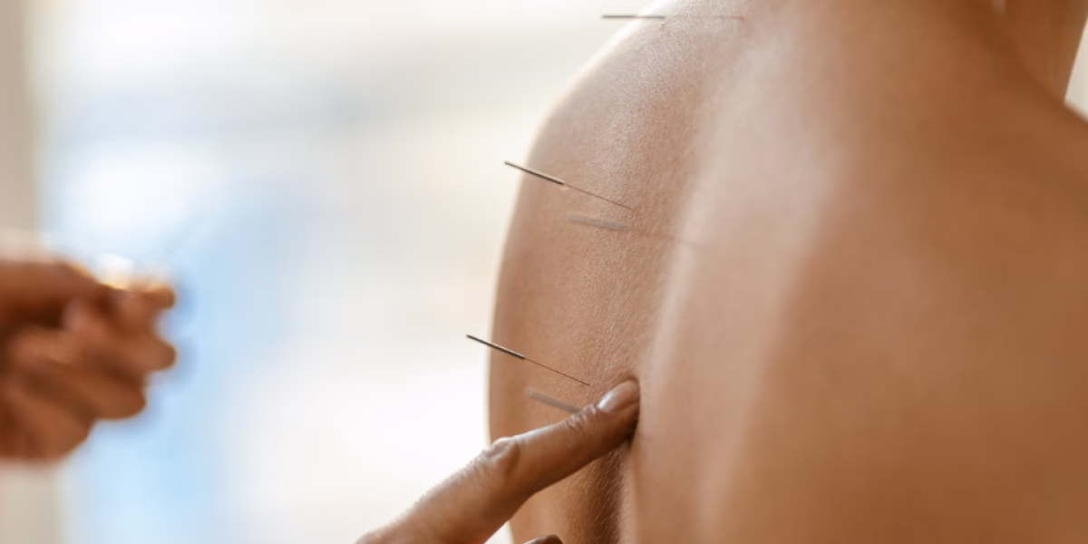 How many acupuncture schools are there in the US?