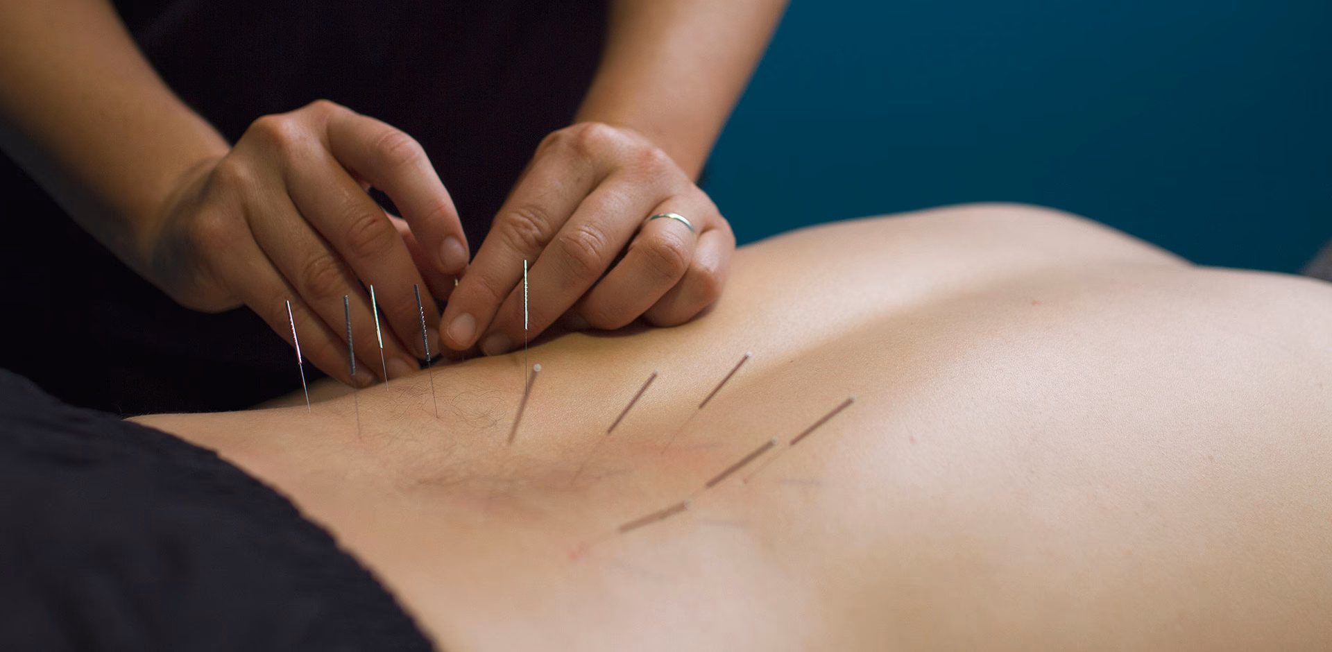 ¿Cuál es el mejor ejercicio para el síndrome de dolor miofascial?
