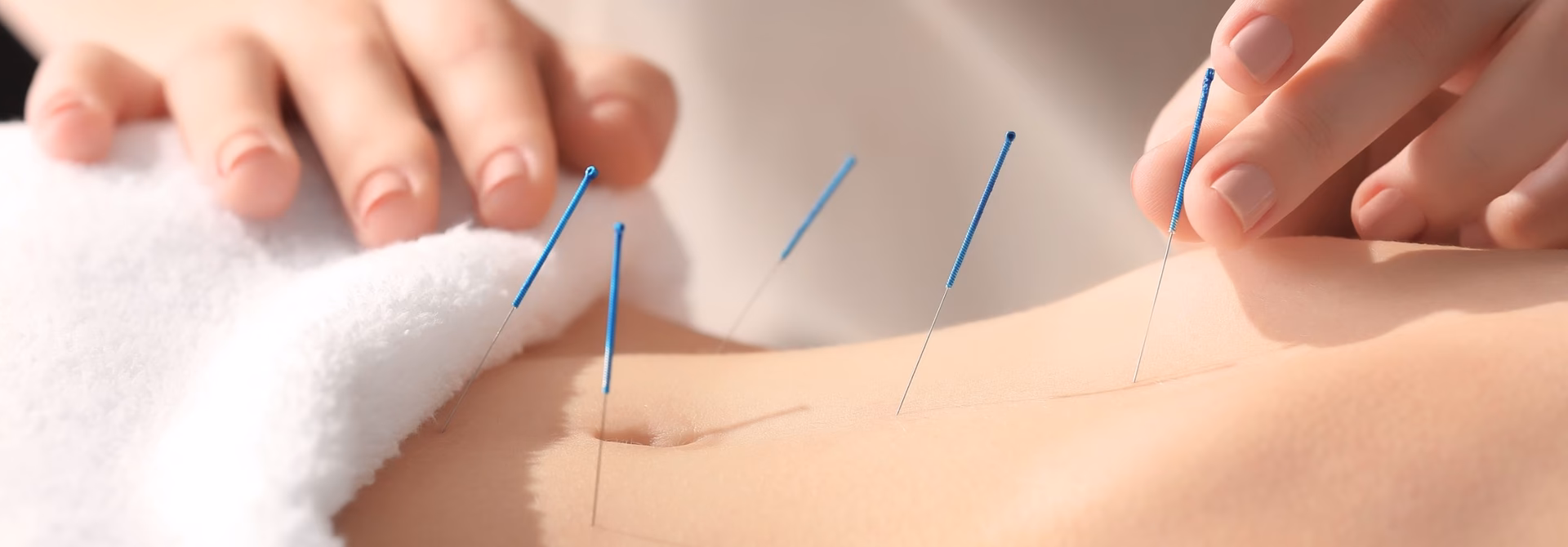 Who can practice acupuncture in Switzerland?