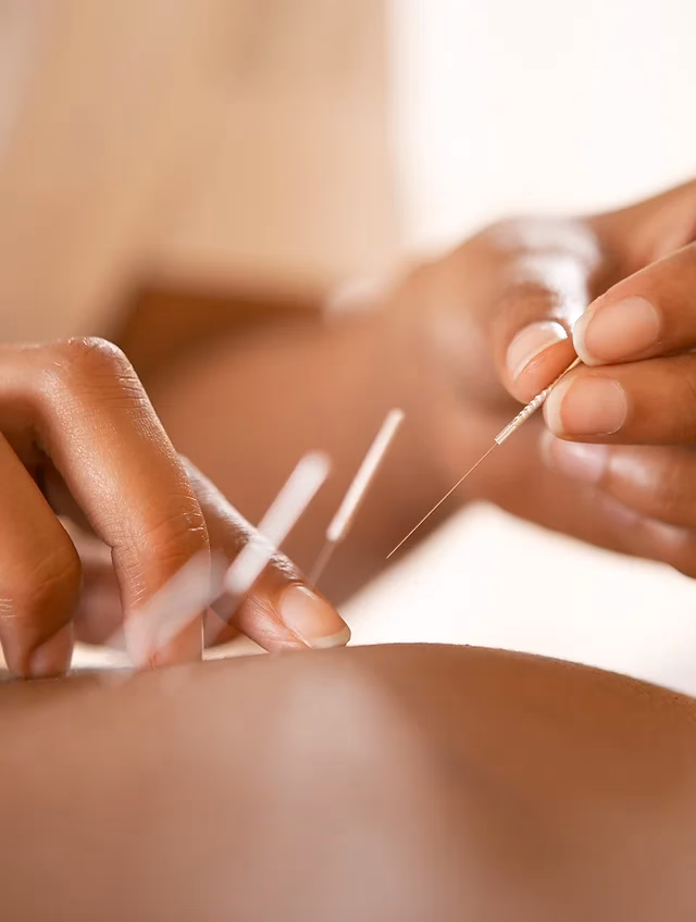 ¿Cuál es la diferencia entre acupuntura y acupotomía?