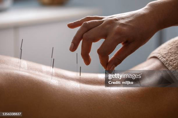 ¿Qué es la acupuntura espiritual?