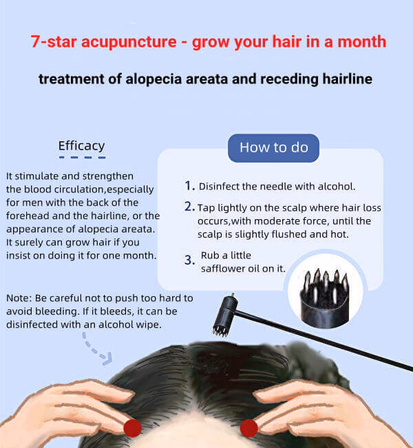 How can I stimulate my hair to grow with alopecia?