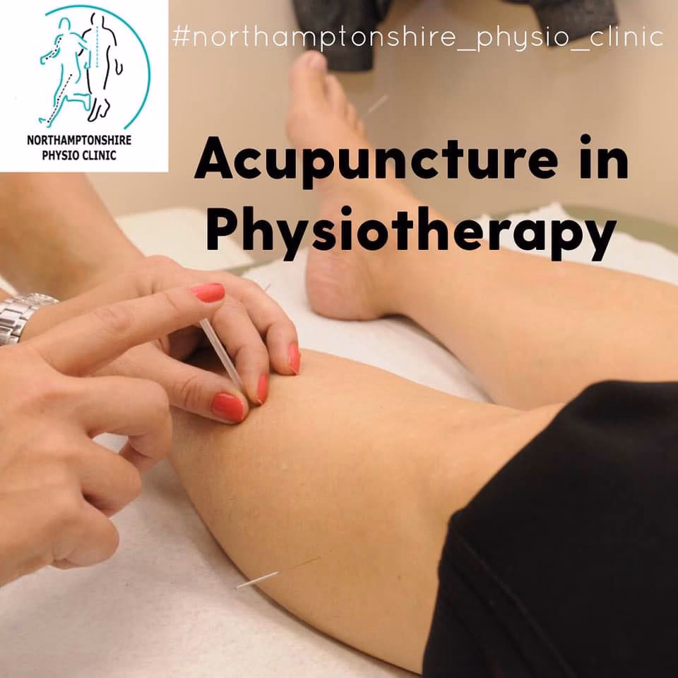 Is acupuncture considered physiotherapy?