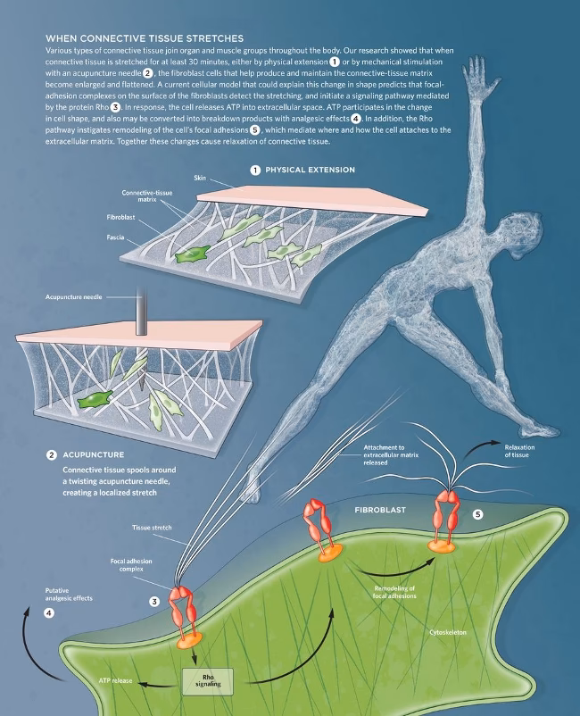 Is acupuncture approved by who?