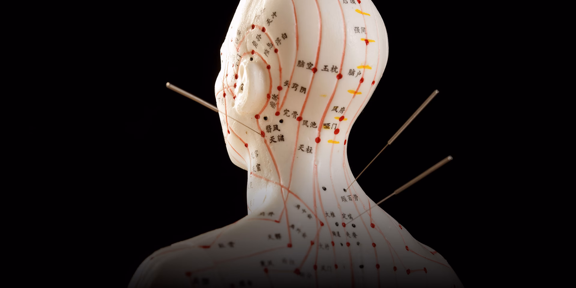 What is the best brand of acupuncture needles?