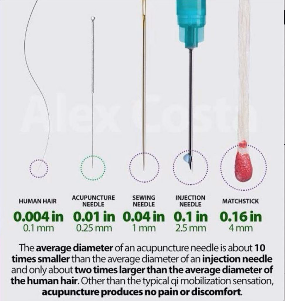What size is a 36 gauge needle in mm?