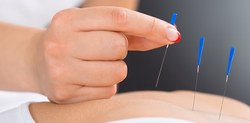 Qual a diferença entre acupuntura e agulhamento a seco?