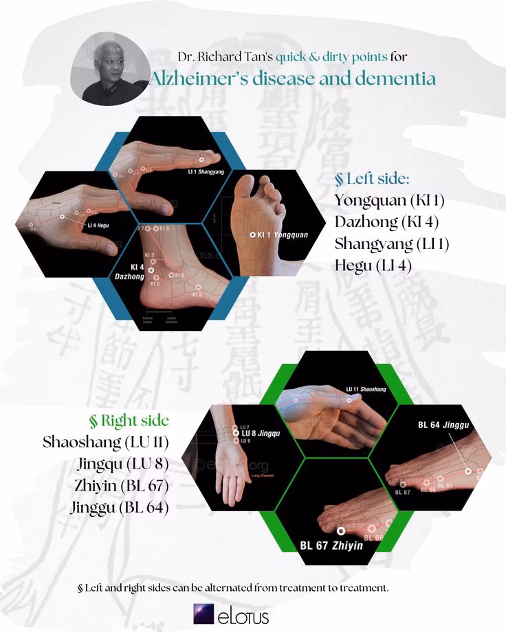 What is the #1 root cause of Alzheimer's?