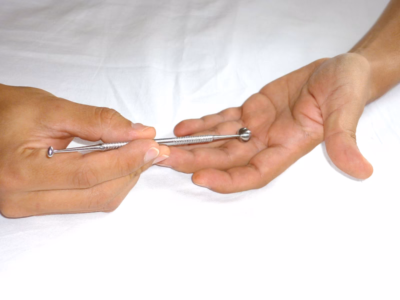 ¿Es posible hacer acupuntura en casa?