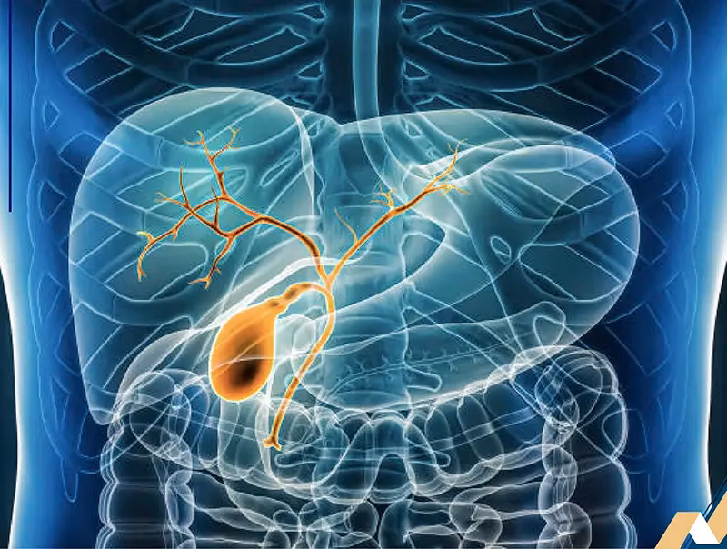 ¿Cómo se desbloquea el conducto biliar?