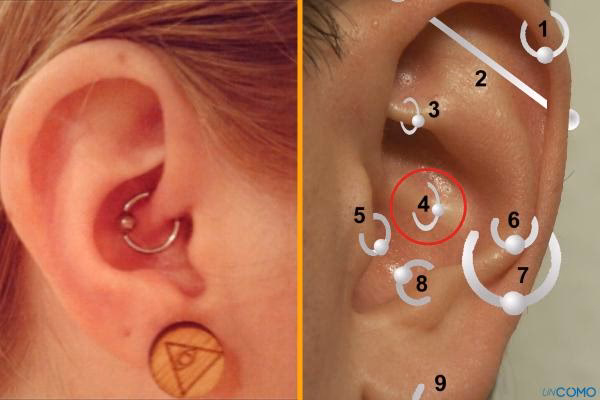 ¿Es efectivo el aro de la migraña?