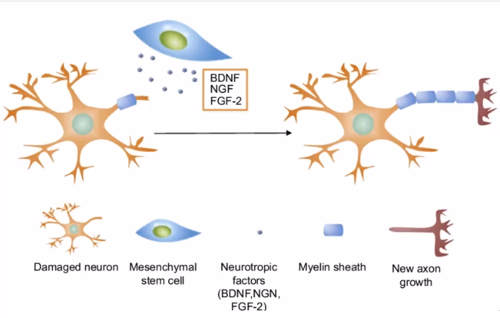 What is the life expectancy of someone with cerebellar ataxia?