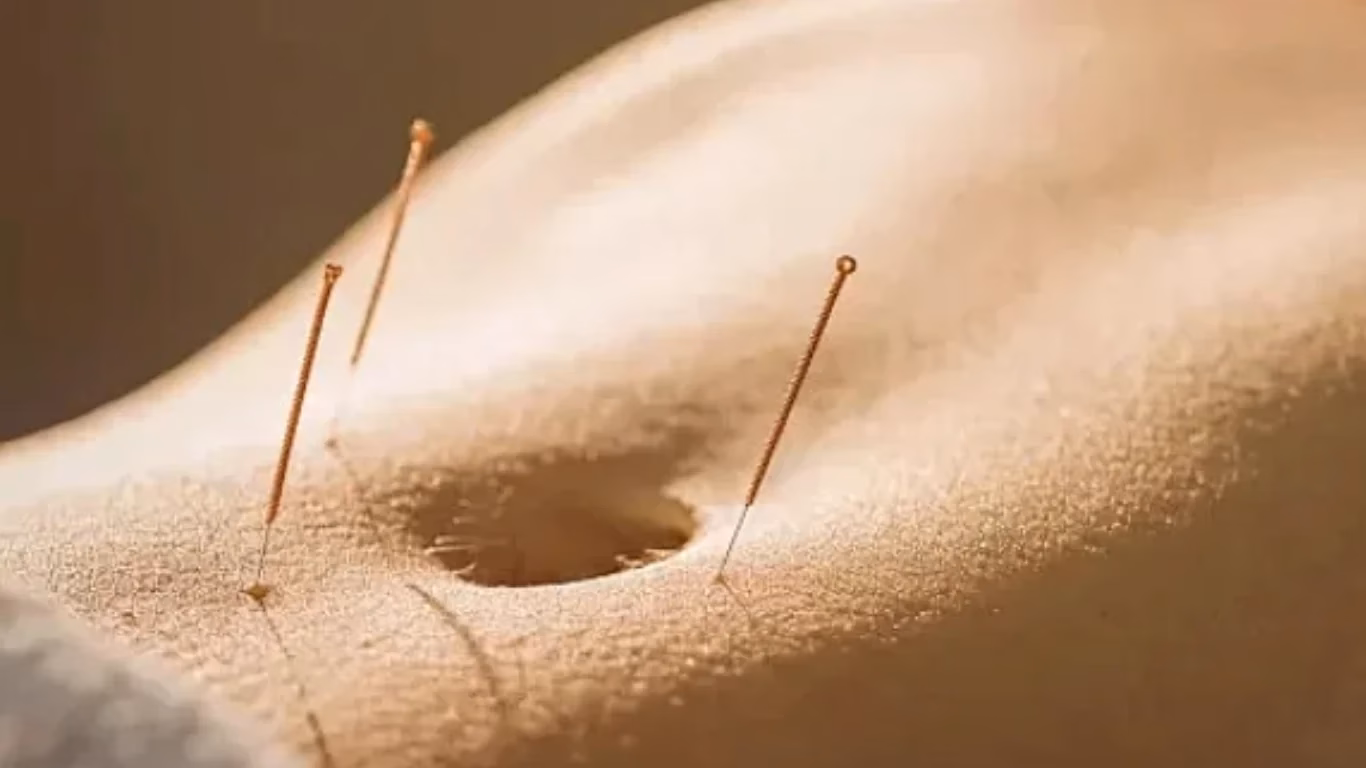 Does acupuncture work for balance problems?