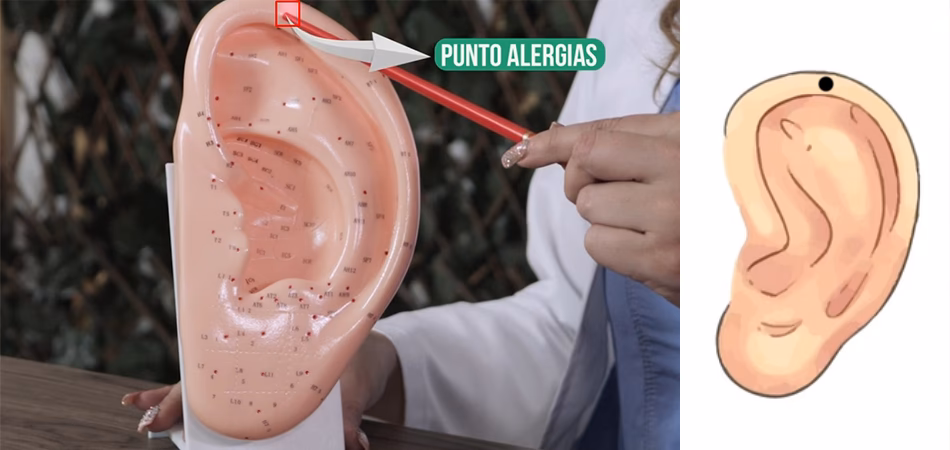 ¿Qué puntos de acupuntura se utilizan para las reacciones alérgicas?