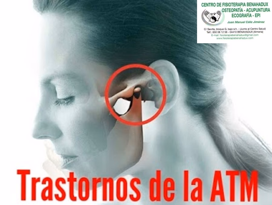 ¿Puede la acupuntura tratar el bruxismo?