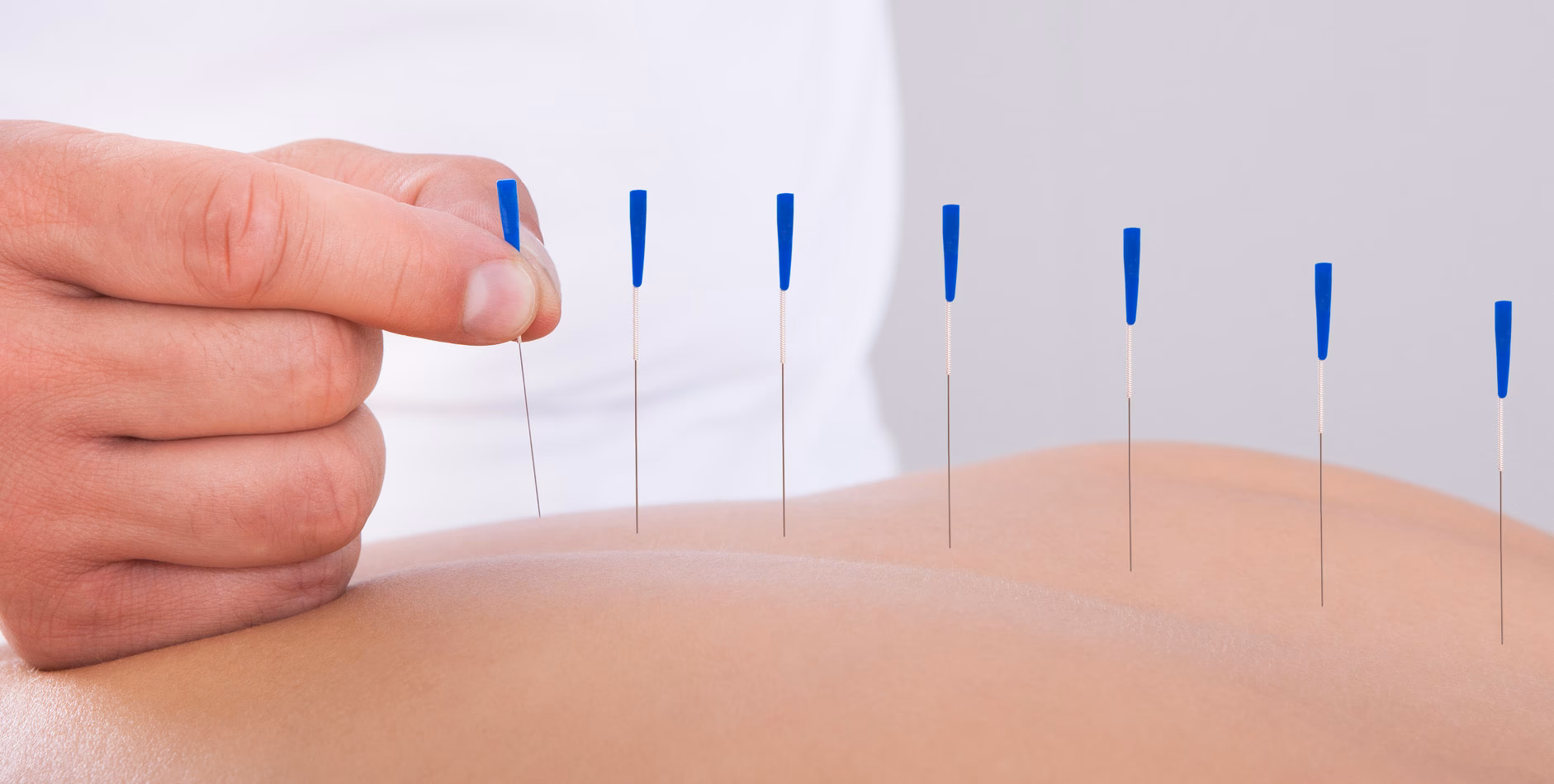 ¿Cómo se llama la carrera de acupuntura?