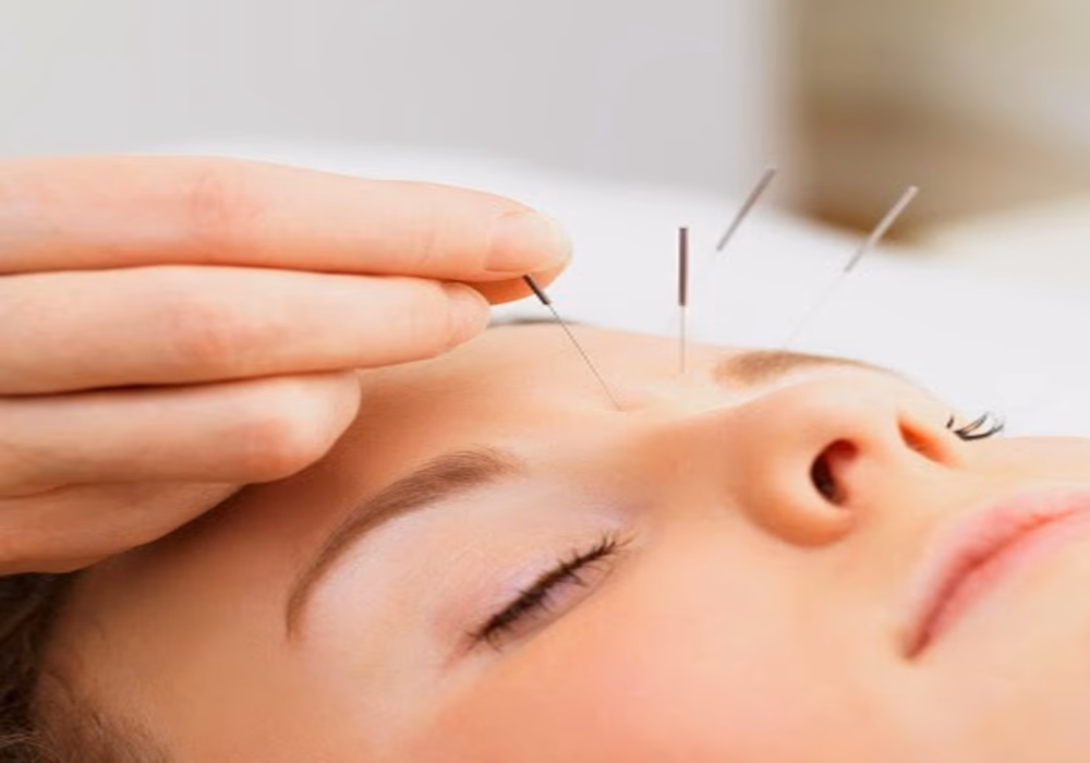 ¿Funciona la acupuntura para los problemas oculares?