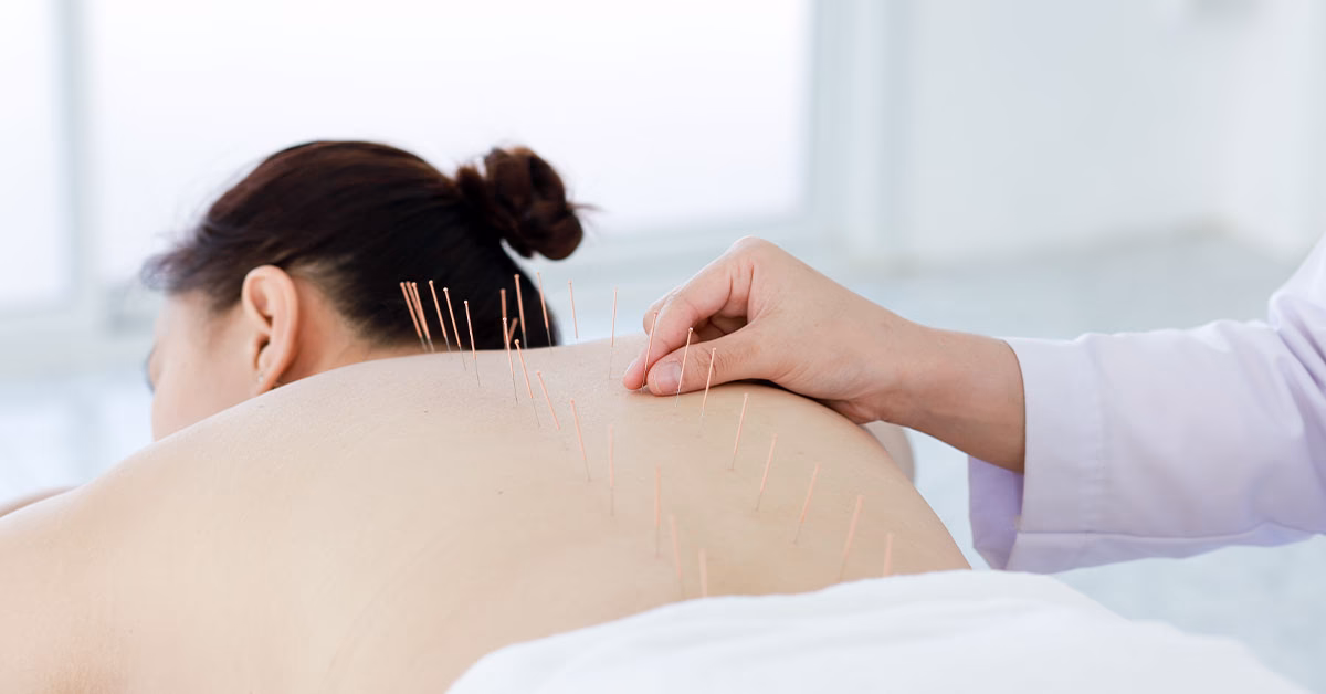 Como tratar cervicalgia com acupuntura?