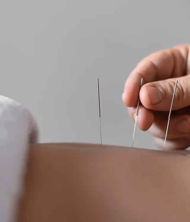 What is more effective, cupping or acupuncture?