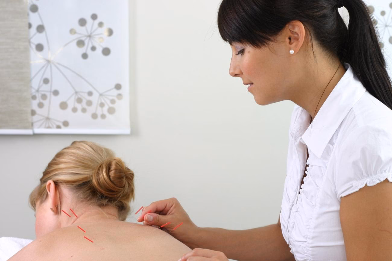 Qui peut exercer l'acupuncture en France ?