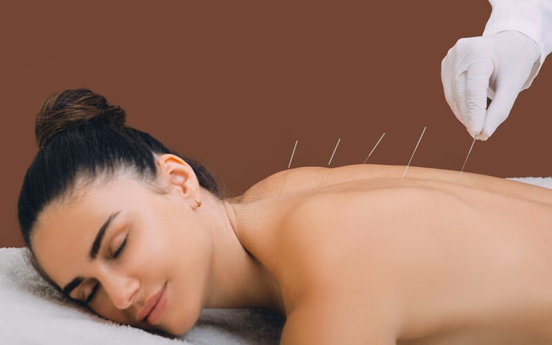 ¿Puede la acupuntura empeorar la endometriosis?