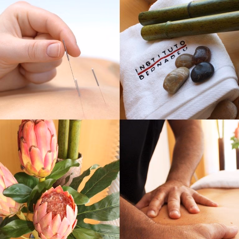 ¿Dónde ponen la acupuntura para la endometriosis?