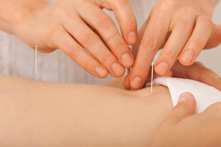What are the techniques used in pediatric acupuncture?