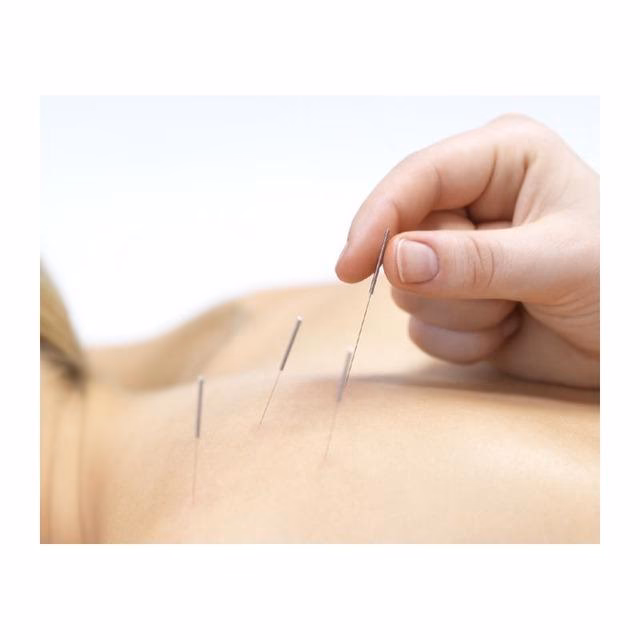 ¿Puede un fisioterapeuta hacer acupuntura?