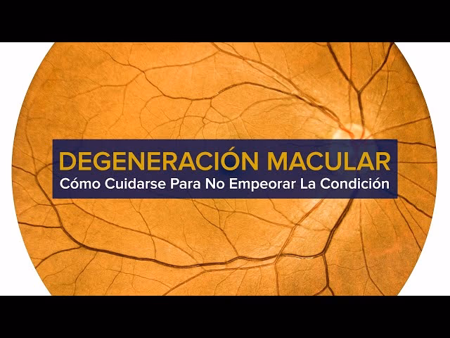 ¿Cómo frenar la degeneración macular seca?