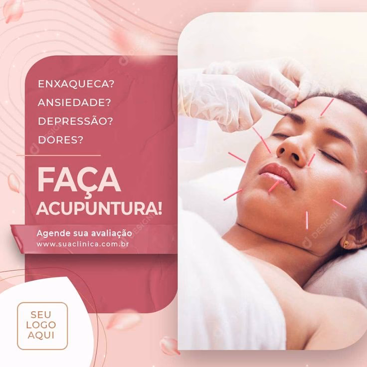 Como conseguir clientes na acupuntura?