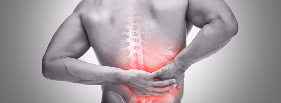 ¿Qué es una condritis costal?