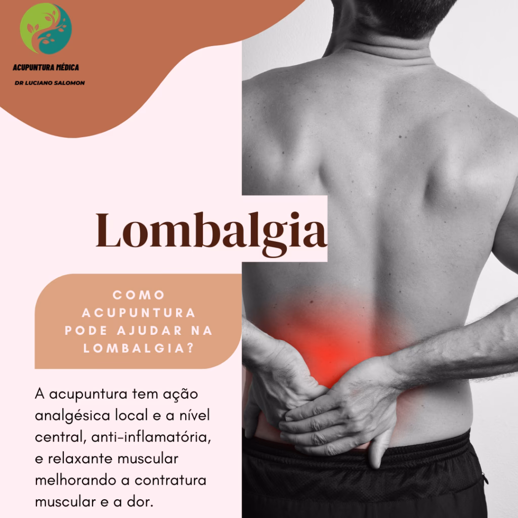 É bom fazer acupuntura para lombalgia?