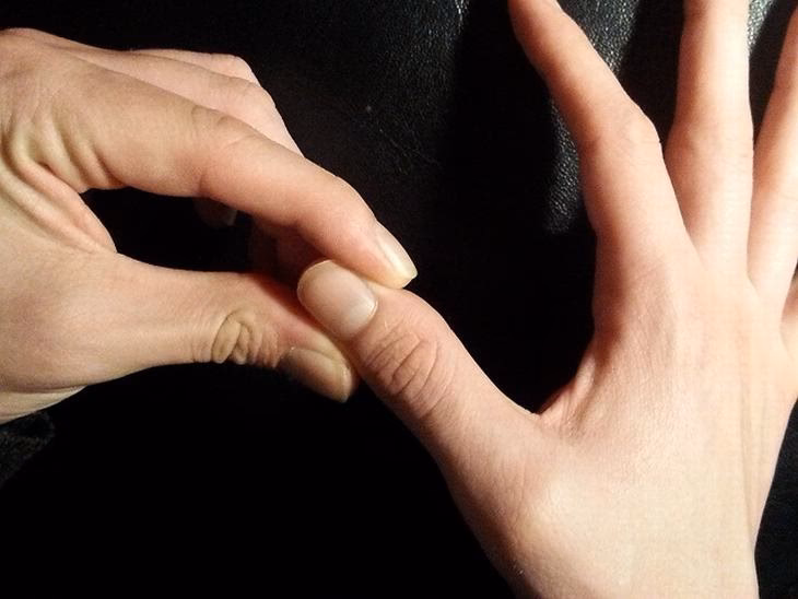 ¿Cómo desinflamar el pulgar?