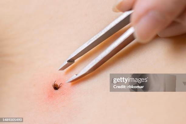 ¿Se puede curar la enfermedad de Lyme con acupuntura?