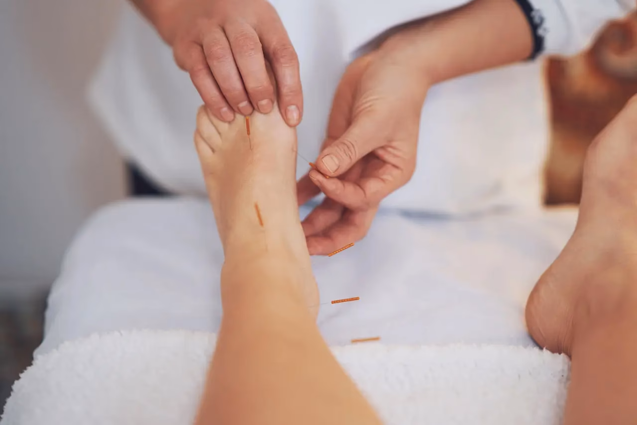 What is fascia plantar?