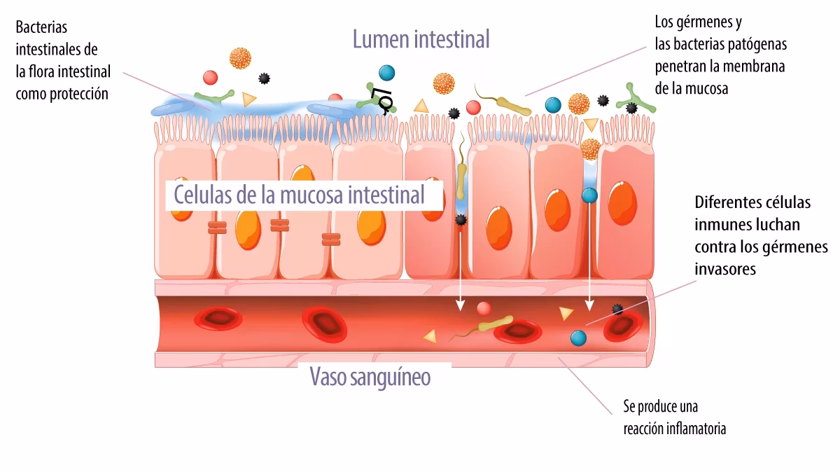 ¿Qué es el tejido linfoide del intestino?